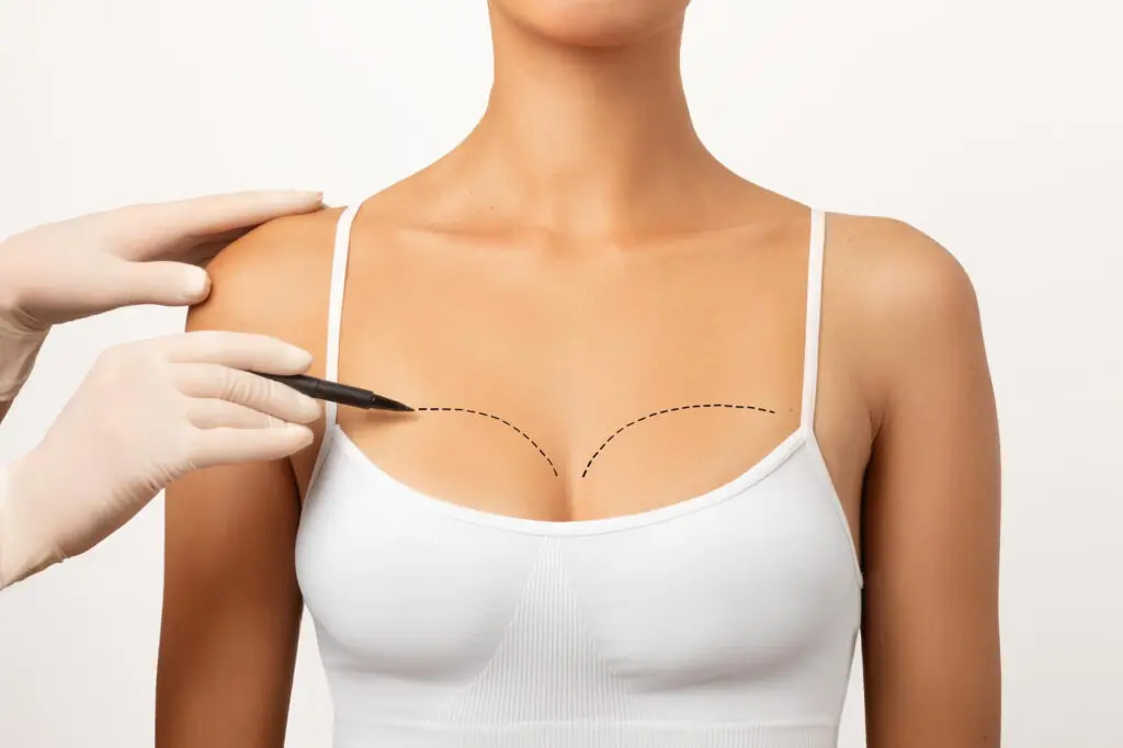 Best breast reduction surgeons Turkey – breast reduction Turkey – affordable breast reduction Turkey – Medicine Park breast reduction – breast reduction before and after Turkey