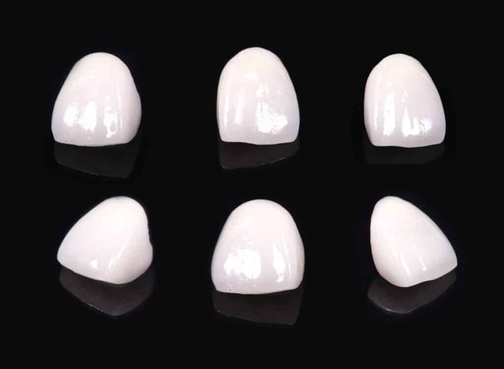 Six unfitted ceramic dental crowns arranged on a black background, showing differences in shape and translucency.